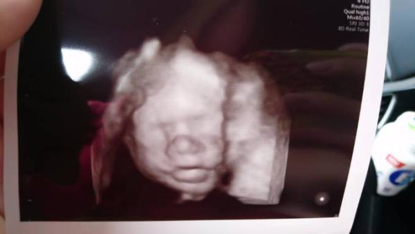 Bild zu Heute wieder Baby TV... - Forum für Oktober - Mamis