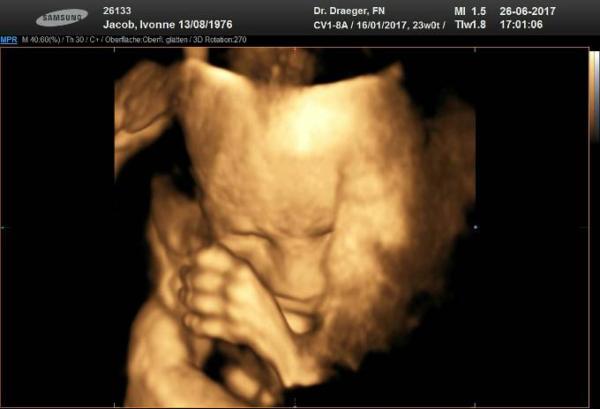 Bild zu Feinultraschall - Forum für Oktober - Mamis