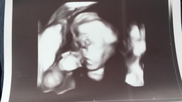 Bild zu FA Besuch :) - Forum für Oktober - Mamis