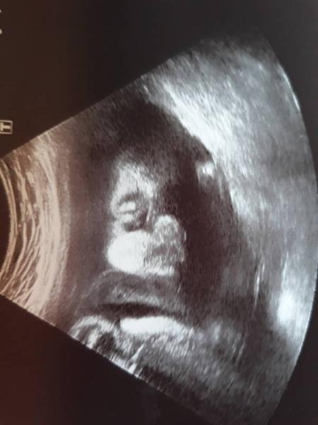 Bild zu FA Termin - Forum für Oktober - Mamis