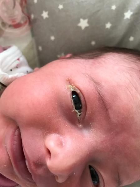 Bild zu Babyauge - Forum für Oktober - Mamis