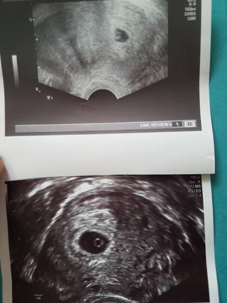 Bild zu Magt ihr eure US Bilder mal zeigen? - Forum für Oktober - Mamis