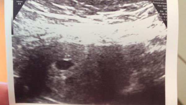 Bild zu Endlich👶🏻Es hat sich gezeigt  - Forum für Oktober - Mamis