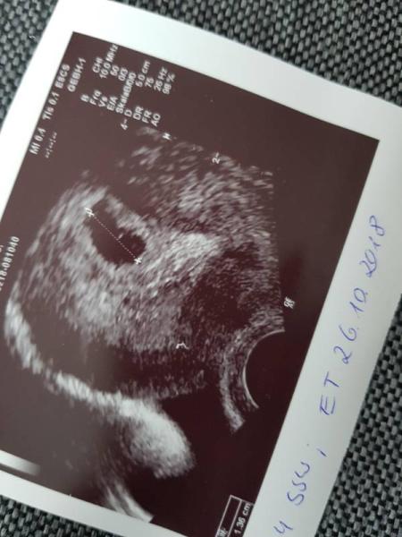 Bild zu Ich bin verliebt #152 - Forum für Oktober - Mamis