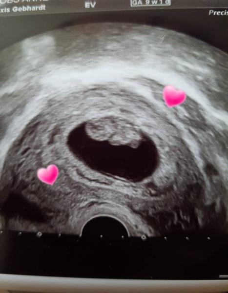 Bild zu Mein Gummibärchen *.* - Forum für Oktober - Mamis