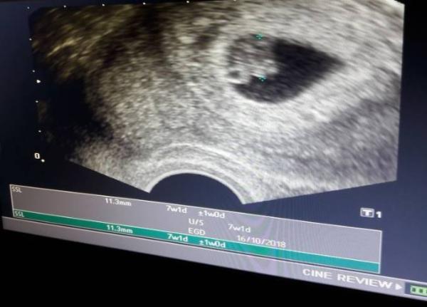 Bild zu 2. US - Forum für Oktober - Mamis