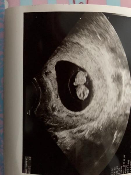 Bild zu Soo glücklich - Forum für Oktober - Mamis