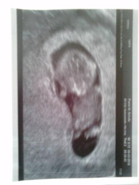 Bild zu Schockverliebt 😍 - Forum für Oktober - Mamis