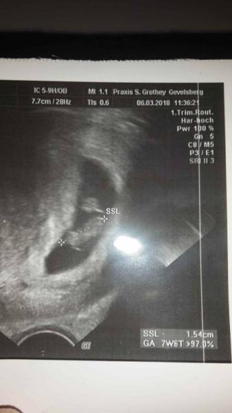 Bild zu Neues Babyfoto - Forum für Oktober - Mamis