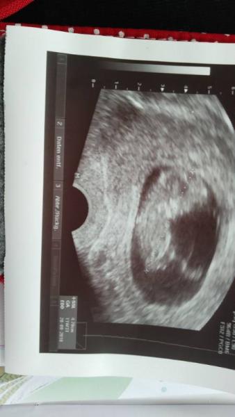 Bild zu 12 SSW mit bild - Forum für Oktober - Mamis
