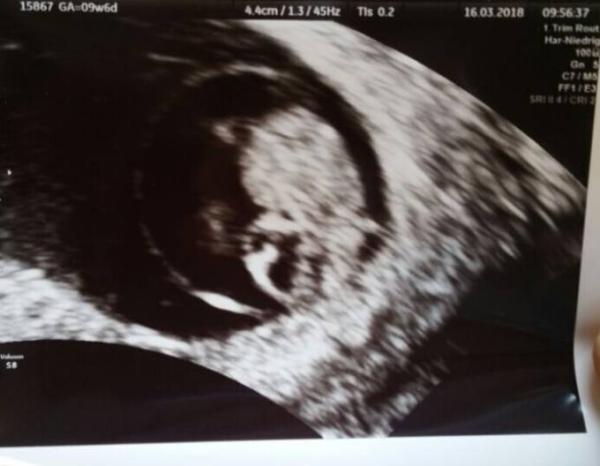 Bild zu Ultraschallbild - Forum für Oktober - Mamis