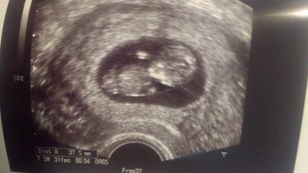 Bild zu FA Termin - Forum für Oktober - Mamis