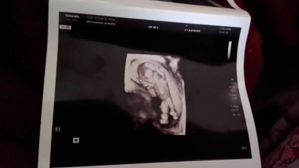 Bild zu heute war das ersttrimester Screening. - Forum für Oktober - Mamis