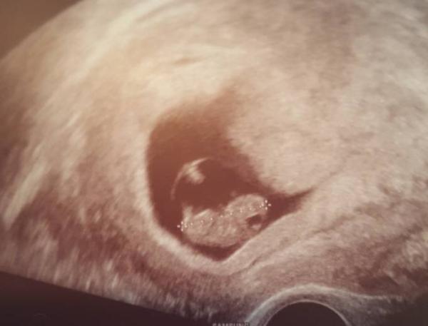 Bild zu Wir haben jetzt Angst..... - Forum für Oktober - Mamis