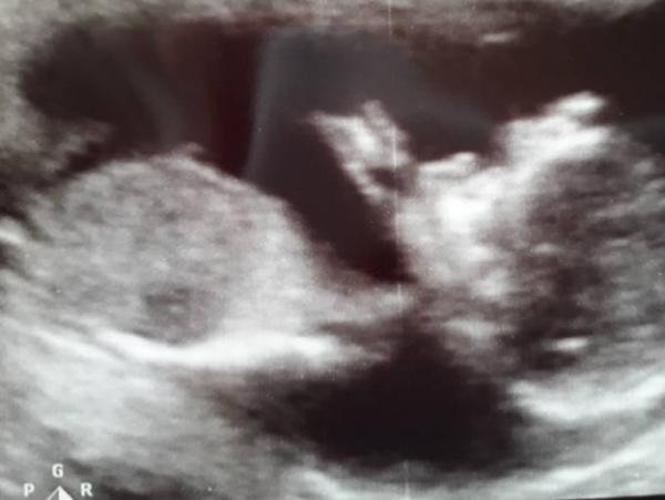Bild zu FA Termin - Forum für Oktober - Mamis