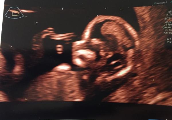 Bild zu Neues Bildchen - Forum für Oktober - Mamis