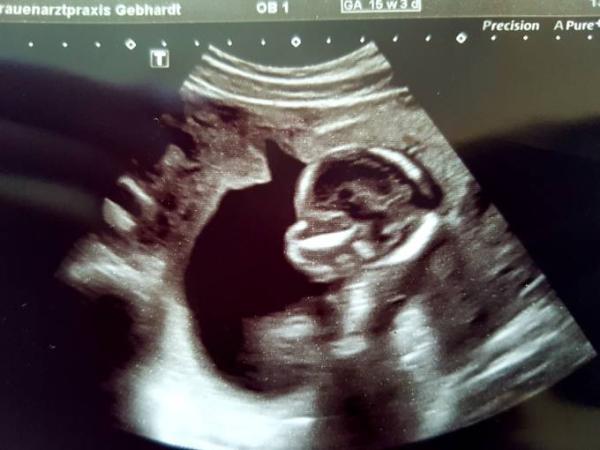 Bild zu Termin gehabt 😍 - Forum für Oktober - Mamis