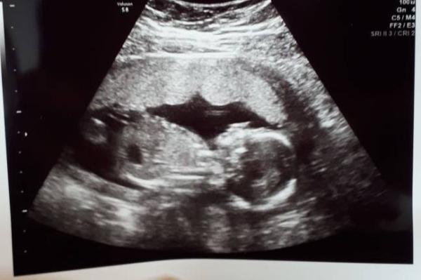 Bild zu FA-Termin - Forum für Oktober - Mamis