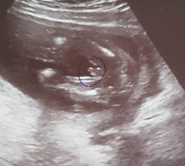 Bild zu Arzt Termin und Outing - Forum für Oktober - Mamis