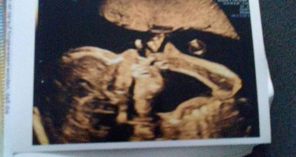 Bild zu Termin gehabt mit guten und schlechten Nachrichten - Forum für Oktober - Mamis
