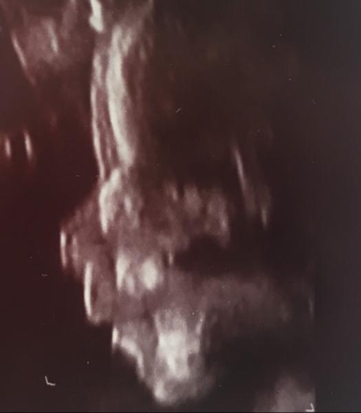 Bild zu Feinultraschall - Forum für Oktober - Mamis