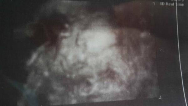 Bild zu Habe ein Gesichtsfoto bekommen - Forum für Oktober - Mamis