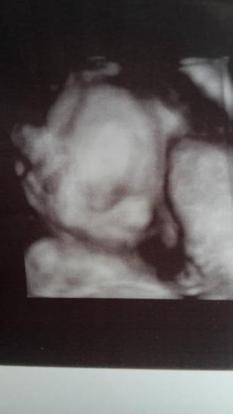 Bild zu Termin gehabt :) - Forum für Oktober - Mamis