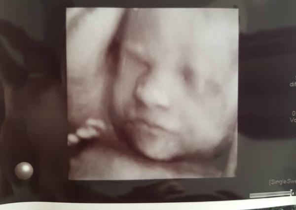 Bild zu 3D auch mit Adipositas - Forum für Oktober - Mamis