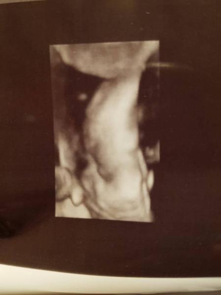 Bild zu Dritter großer Ultraschall - Forum für Oktober - Mamis