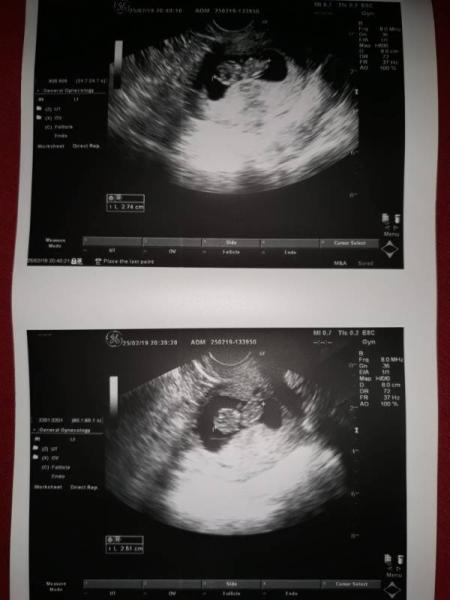 Bild zu Darf ich auch mitfahren Mädels? - Forum für Oktober - Mamis