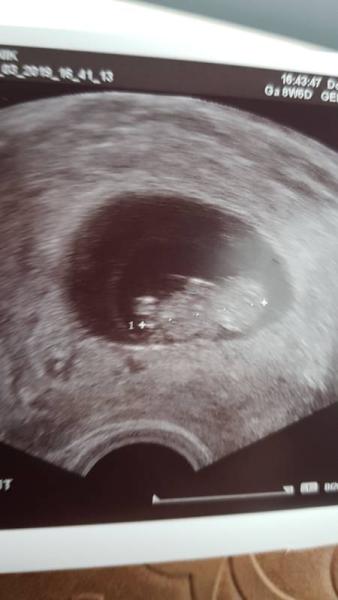 Bild zu Offiziell schwanger - Forum für Oktober - Mamis