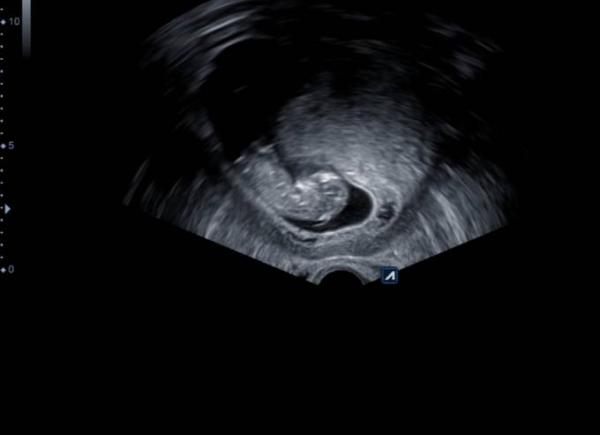 Bild zu Zurück von FA ❤ - Forum für Oktober - Mamis