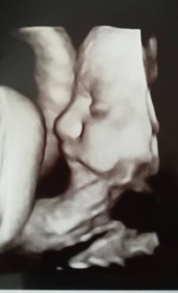 Bild zu Zurück vom FA und Riesenbaby - Forum für Oktober - Mamis