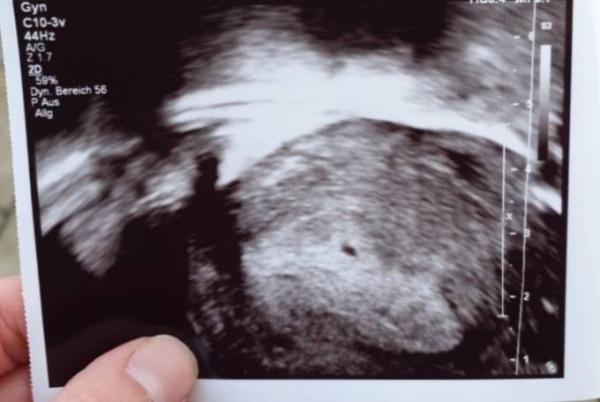 Bild zu Erster FA Termin - Forum für Oktober - Mamis