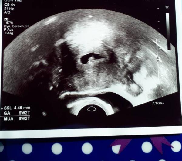 Bild zu Zurück vom FA 5+5 - Forum für Oktober - Mamis