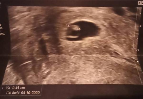 Bild zu Re Kugelliste 1.0 - Forum für Oktober - Mamis