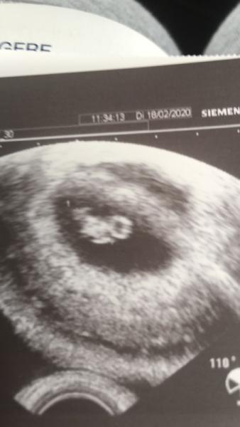 Bild zu Termin auf heute vorgezogen - Forum für Oktober - Mamis