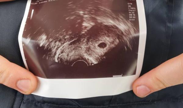 Bild zu Sieht das nach einem Windei aus? - Forum für Oktober - Mamis