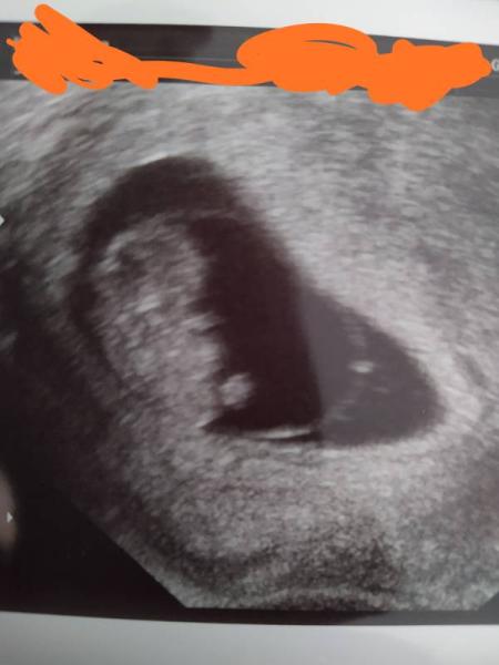 Bild zu Wieder ein Update - Forum für Oktober - Mamis