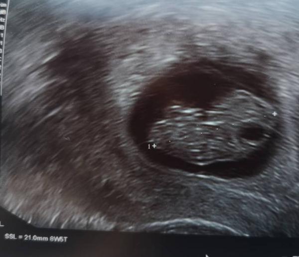 Bild zu Gestern FA - Forum für Oktober - Mamis