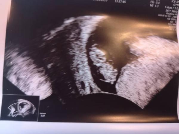 Bild zu Update Frauenarzt - Forum für Oktober - Mamis