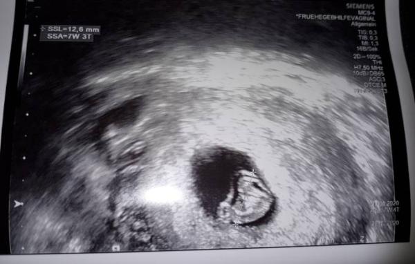 Bild zu Auch bei uns schlägt das Herz ♡ - Forum für Oktober - Mamis