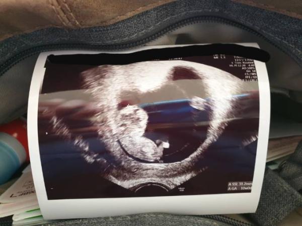 Bild zu Heute auch wieder einen Kontrolltermin gehabt - Forum für Oktober - Mamis