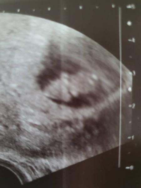 Bild zu Sorge mal wieder unbegeündet - Forum für Oktober - Mamis