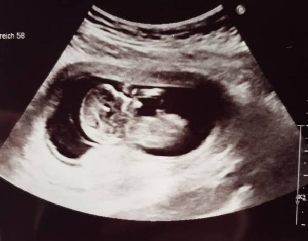 Bild zu Heutiger FA Termin. - Forum für Oktober - Mamis