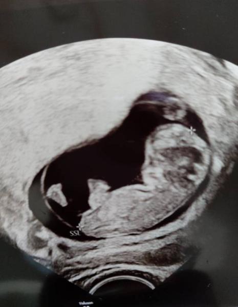 Bild zu Geschlecht? - Forum für Oktober - Mamis
