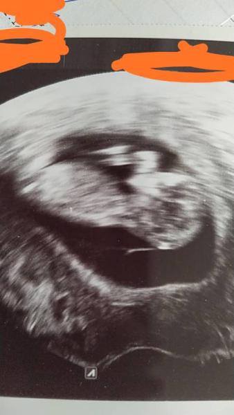 Bild zu FA Termin - Forum für Oktober - Mamis