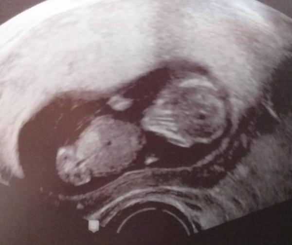 Bild zu Zurück vom Arzt - Forum für Oktober - Mamis