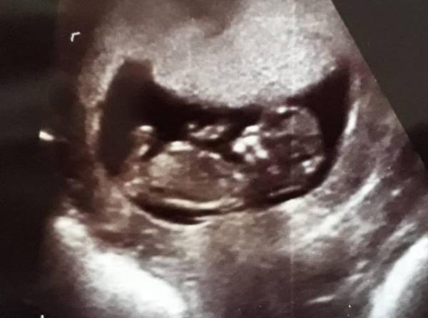 Bild zu 2. Date mit dem Krümel - Forum für Oktober - Mamis