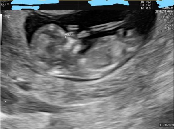 Bild zu Zurück vom NT - Forum für Oktober - Mamis